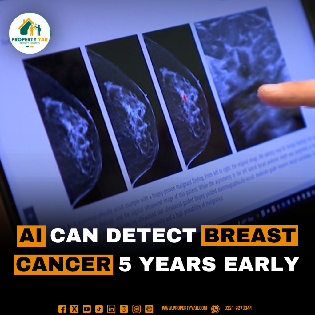 AI can detect breast cancer 5 years early.